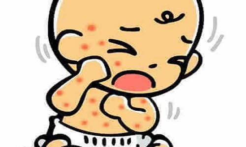 湿疹止痒妙招也有科学的方法，宝宝湿疹怎么引起的？